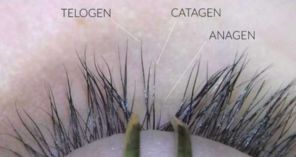 В ресничном ряду расположены волоски на разном жизненном этапе (телоген, катаген, анаген)