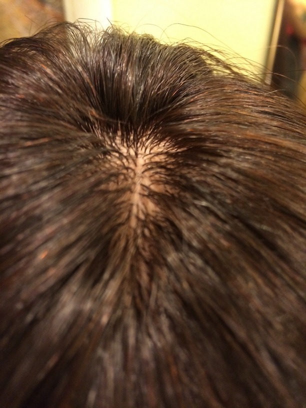 Система волос с имитацией кожи головы