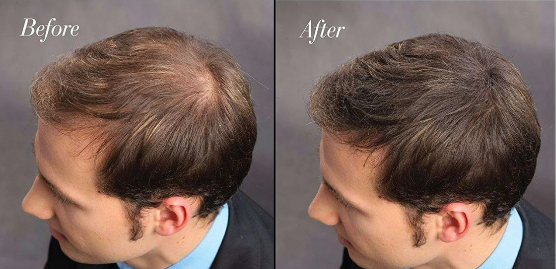 Эффект применения камуфляжа для волос, до и после